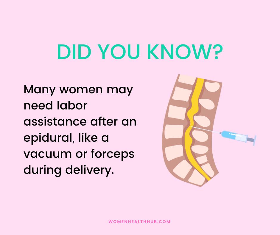 Epidural in labor - women health hub