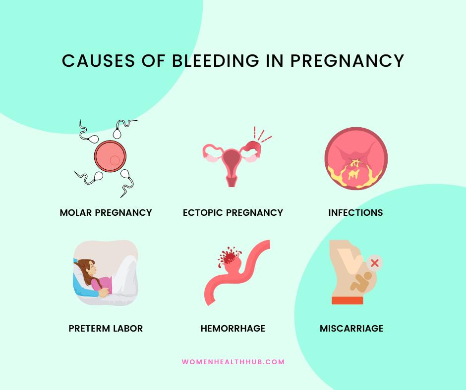 do women get periods during pregnancy - women health hub