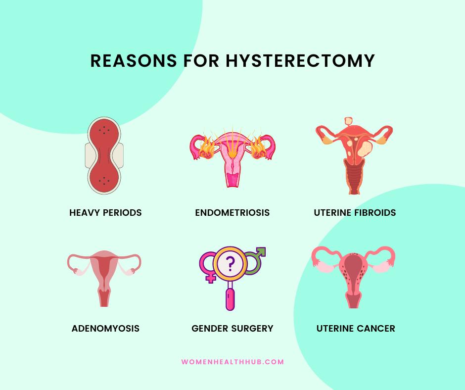 why women need hysterectomy - women health hub